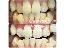 ホワイトニングルーム 横浜店(Whitening Room)/セルフホワイトニング/横浜