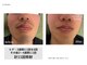 ルミナ(LUMINA)の写真