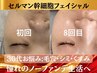 《艶肌と小顔を同時に叶える》艶増し、たるみ改善★水光肌管理＋大理石かっさ