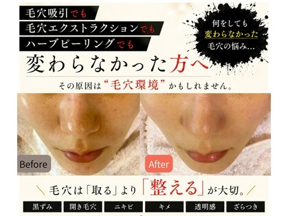 毛穴研究所の写真