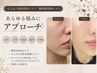 8月☆限定5名様☆韓国美肌/肌管理 セルダムエステ ￥16500⇒￥9900