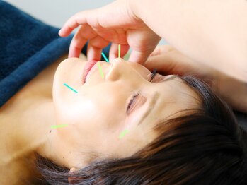 サボテン/美容鍼