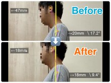 立川カイロプラクティック/矯正☆Before-After☆