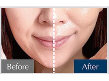 ナチュラルビューティーサロン ルレーヴ代官山(natural beauty salon LeReve)の雰囲気（【美顔矯正】塗るリフトアップ成分×創顔マッサージ・ヘッドスパ）