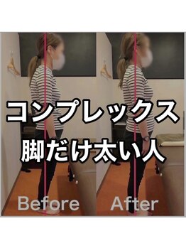 カワル整体 上通り院/脚だけ太りやすい人