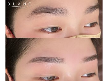 アイラッシュサロン ブラン イオンモールとなみ店(Eyelash Salon Blanc)の写真/【つるんと、まあるいおでこは輪郭が綺麗に見え透明感UP!】眉wax&おでこwaxセットがおすすめ◎