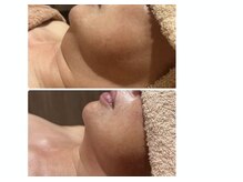 スリー 桜木町(Three)の雰囲気（術後ケアから筋膜アプローチの小顔矯正も【初回50分¥5500/横浜】）
