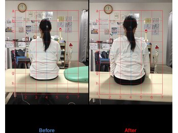ストレチックス 近江八幡店/姿勢改善ビフォーアフター1回