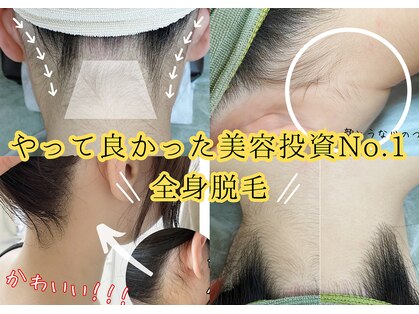 ユーサロン(U-Salon)の写真
