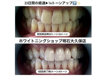 ホワイトニングショップ 明石大久保店の写真/ホワイトニングは高額なイメージ？学生様でも通いやすい価格設定◎初めての方でも初めやすいホワイトニング