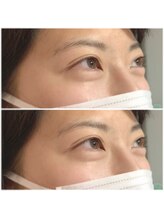 ミント アイラッシュ(mint)/