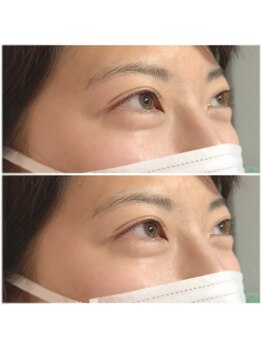 ミント アイラッシュ(mint)/