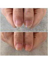 イル(iLL)/自爪育成～最強のネイルケア