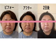 サロンドミジュ(Salon de 美jyu)/小顔・骨格矯正　30代