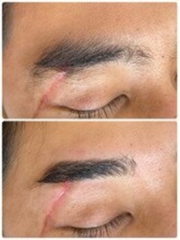 リルモナ(RIREMONA)/