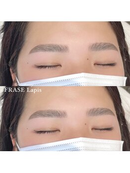 フレイズラピス(FRASE Lapis)/ハリウッドブロウリフト