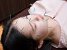 美容鍼40分　¥12,100