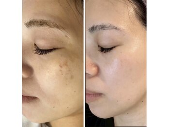 エクレクティック(ECLECTIC)