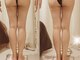 上野エステサロン レア(Lea)の写真/全身くまなく痩身&理想のBODYラインへ!短期集中でしっかり結果出し!強力5台痩身マシンかけ放題《女性専用》