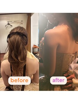 グレフル鍼灸接骨院 整体院 心斎橋/ブライダル/肩甲骨はがし/美鎖骨