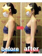 ビアージュ 蕨店(viage)/バスト施術で美姿勢に！