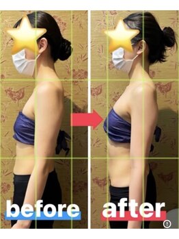 ビアージュ 蕨店(viage)/バスト施術で美姿勢に！