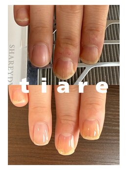 ティアレ(tiare)/１ヶ月の変化