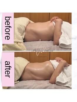 ルミライズヴィブリス(lumirise vibliss)/腸もみ＋小顔矯正5回目