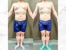 パラディ(PARADIS)/ハイパーナイフ/シェイプ