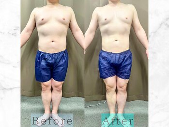 パラディ(PARADIS)/ハイパーナイフ/シェイプ