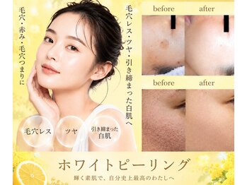 イーズ ミュゼ  ららぽーと横浜店の写真/『毛穴レス艶肌☆ホワイトピーリング￥5500』乳酸ピール×幹細胞×高濃度ピュアビタミンCで集中美白！