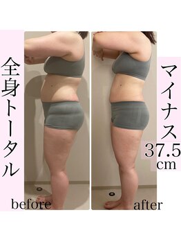 エミィシア(Emisia)/筋膜リリースダイエット