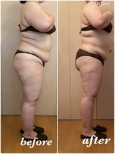 アンフィニ(infini)/短期集中コース10回目（2.5ヶ月)