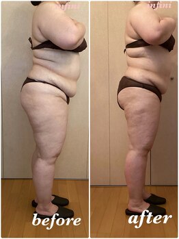 アンフィニ(infini)/短期集中コース10回目(2.5ヶ月)