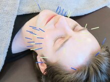 エイト鍼灸 整骨院 表参道(8eight鍼灸 整骨院)/全身整体【鍼灸/整体/肩こり】