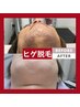 【見た目＆剃刀負け改善】メンズヒゲ脱毛★都度払いモニター¥12,000→¥7,500