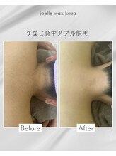 ジョエルワックス 沖縄コザ店(JOELLE WAX)/うなじ背中ダブル脱毛☆ミ