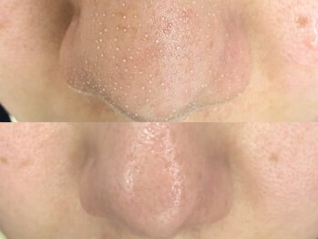 ライリー(Rairy)/スッキリ毛穴洗浄♪