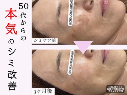 ミニョン(Mignon)の写真