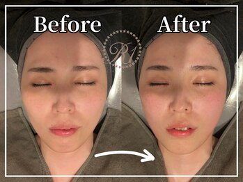 R-1ビューティーサロン 銀座/Before&After