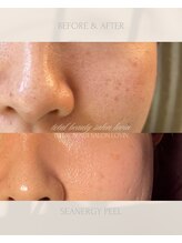 ラヴィン なんばスカイオ店(Lovin)/シーナジーピーリング