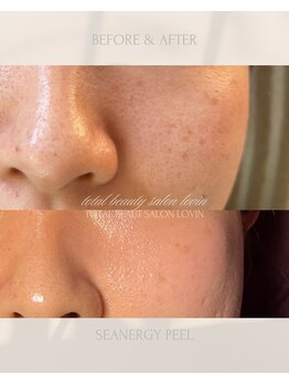 ラヴィン なんばスカイオ店(Lovin)/シーナジーピーリング