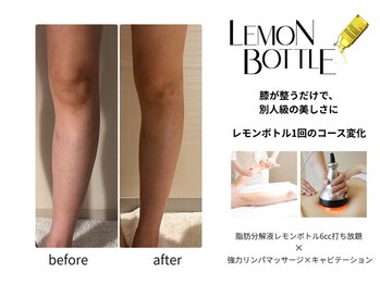 クリニカルエステ イーズ あべのキューズタウン店/BODYレモンボトル変化写真-1