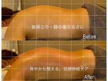 カシェットベルメイユ 名古屋久屋大通(Cachette Vermeil)の雰囲気（首肩こり・腰の重だるさに｜背中から整え、巡りと軽さを実感）