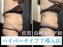 骨盤ダイエットサロン カンフリエ(camphrier)の雰囲気（最新機種導入★+骨盤矯正で根本から見直す★　[鳥栖痩身]）