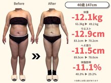 ニドム/40代　5か月　12kgダイエット 1