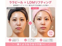 セレブリティ(Celebrity)/ララピール