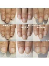 ニコプラス(NICO+)/自爪育成パラジェルクリア補強