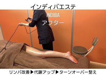 久留米スポーツ整骨院 整体院/エステ◆インディバエステ