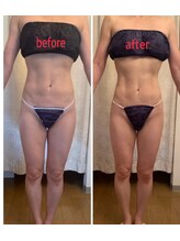 パルフェット(parfaite)/お腹の腹筋カット出し